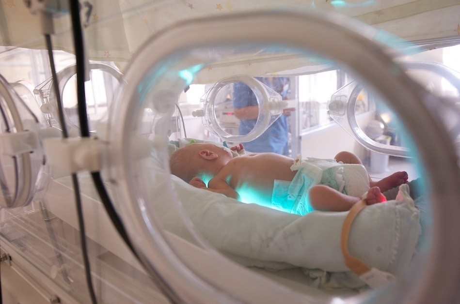 Фото Недоношенного Новорожденного Ребенка